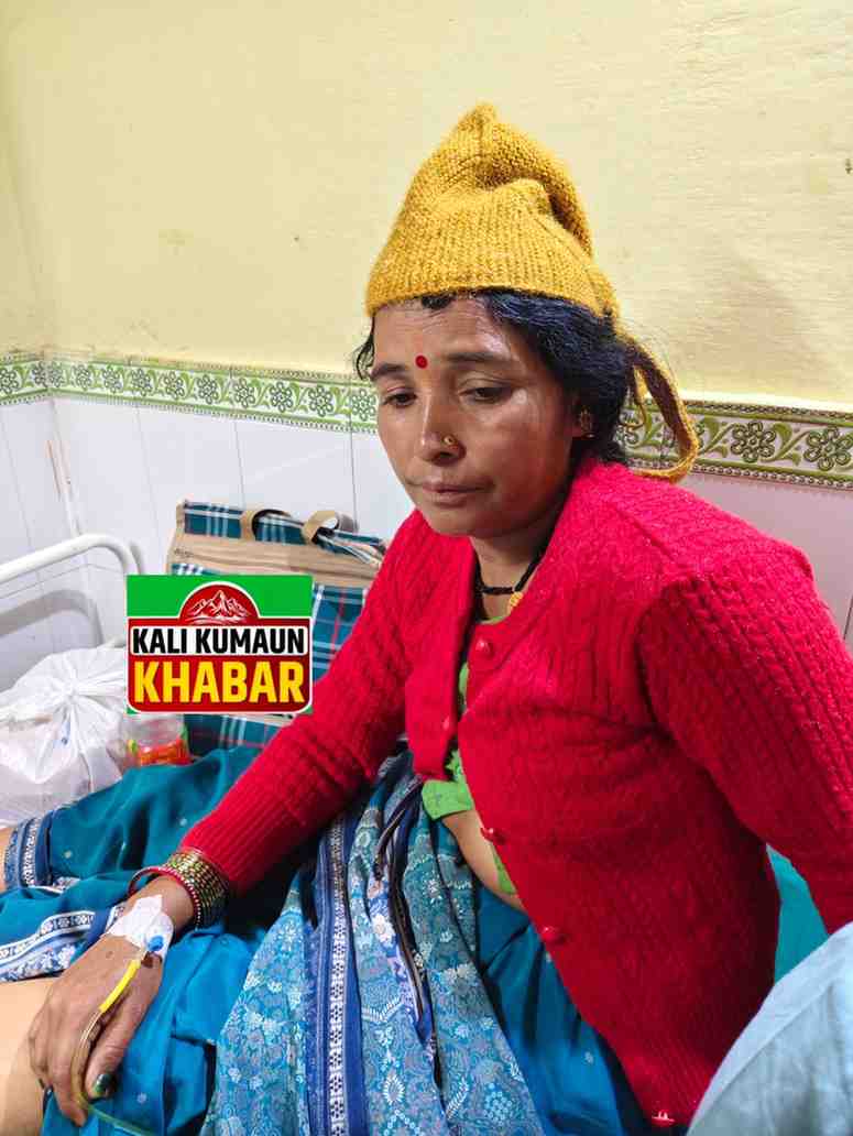 लोहाघाट:डनगांव मे सांप के काटने से महिला की बिगड़ी हालत अस्पताल में भर्ती। चिकित्सकों ने बचाई जान। 
